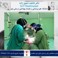 عمل هیسترکتومی در یک خانم ۴۸ساله مولتی پار 2 عمل هیسترکتومی در یک خانم ۴۸ساله مولتی پار 2