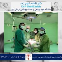 عمل هیسترکتومی در یک خانم ۴۸ساله مولتی پار 4 عمل هیسترکتومی در یک خانم ۴۸ساله مولتی پار 4