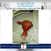 بیمار خانم ۴۷ ساله 1 بیمار خانم ۴۷ ساله 1