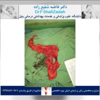 بیمار خانم ۴۷ ساله 2 بیمار خانم ۴۷ ساله 2