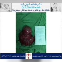 بیمار خانم ۴۷ ساله 3 بیمار خانم ۴۷ ساله 3