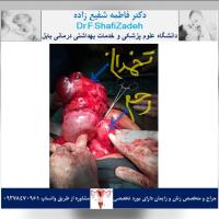 بیمار خانم ۴۷ ساله 4 بیمار خانم ۴۷ ساله 4