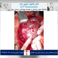 بیمار خانم ۴۷ ساله 7 بیمار خانم ۴۷ ساله 7