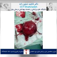 بیمار خانم ۴۱ ساله 1 بیمار خانم ۴۱ ساله 1