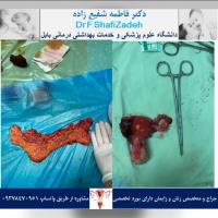 بیمار خانم ۵۴ ساله 3 بیمار خانم ۵۴ ساله 3