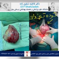 بیمار خانم ۵۴ ساله 4 بیمار خانم ۵۴ ساله 4