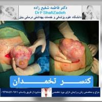 بیمار خانم ۵۴ ساله 5 بیمار خانم ۵۴ ساله 5