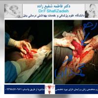 بیمار خانم ۳۶ ساله 1 بیمار خانم ۳۶ ساله 1