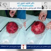 بیمار خانم ۳۶ ساله 2 بیمار خانم ۳۶ ساله 2