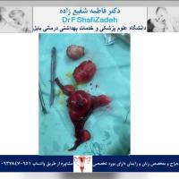 بیمار خانم ۴۶ ساله 1 بیمار خانم ۴۶ ساله 1