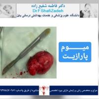 بیمار خانم ۴۶ ساله 3 بیمار خانم ۴۶ ساله 3