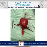 بیمار خانم ۵۴ ساله 1 بیمار خانم ۵۴ ساله 1