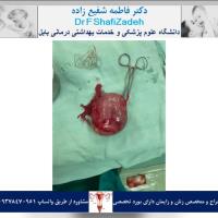 بیمار خانم ۴۳ ساله 1 بیمار خانم ۴۳ ساله 1