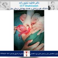بیمار خانم ۴۳ ساله 2 بیمار خانم ۴۳ ساله 2