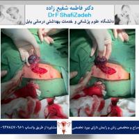 دختر بچه ۱۰ ساله 1 دختر بچه ۱۰ ساله 1