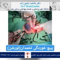 دختر بچه ۱۰ ساله 4 دختر بچه ۱۰ ساله 4