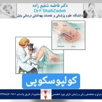 کولپوسکوپی 2 کولپوسکوپی 2