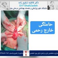 بیمار خانم 32 ساله 4 بیمار خانم 32 ساله 4