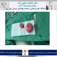 بیمار خانم 33 ساله 1 بیمار خانم 33 ساله 1