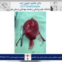 بیمار خانم 41 ساله 1 بیمار خانم 41 ساله 1
