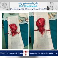 بیمار خانم 53 ساله 1 بیمار خانم 53 ساله 1