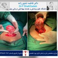 بیمار خانم 53 ساله 3 بیمار خانم 53 ساله 3