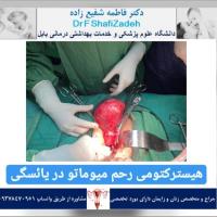 بیمار خانم 53 ساله 4 بیمار خانم 53 ساله 4