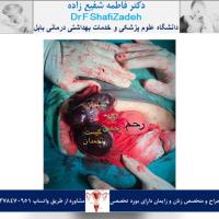 بیمار خانم 39 ساله 1 بیمار خانم 39 ساله 1