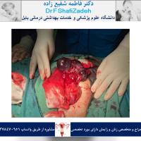 بیمار خانم 39 ساله 2 بیمار خانم 39 ساله 2
