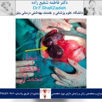 بیمار خانم 39 ساله 3 بیمار خانم 39 ساله 3