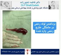 بیمارستان 4 بیمارستان 4