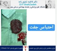 احتباس جفت 3 احتباس جفت 3
