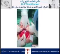 حاملگی پرخطر 8 حاملگی پرخطر 8