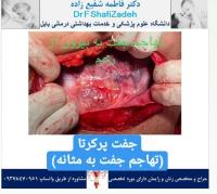 حاملگی پرخطر 12 حاملگی پرخطر 12