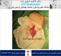 جراحی روز ۲ شهریور 1 جراحی روز ۲ شهریور 1