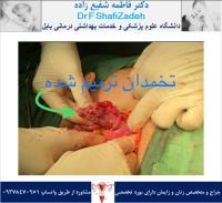 جراحی روز ۲ شهریور 2 جراحی روز ۲ شهریور 2