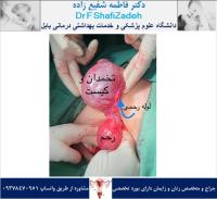 جراحی روز ۲ شهریور 4 جراحی روز ۲ شهریور 4