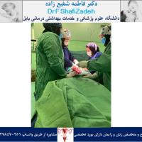 چرخش رحم 3 چرخش رحم 3