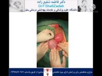 چرخش رحم 6 چرخش رحم 6