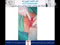 چرخش رحم 7 چرخش رحم 7