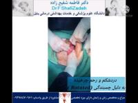 چرخش رحم 8 چرخش رحم 8
