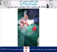 چرخش تخمدان 5 چرخش تخمدان 5