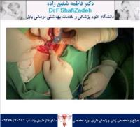 چرخش تخمدان 6 چرخش تخمدان 6