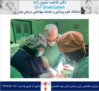 آدنومیوز رحم 1 آدنومیوز رحم 1