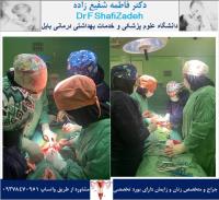 آدنومیوز رحم 3 آدنومیوز رحم 3