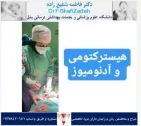 آدنومیوز رحم 5 آدنومیوز رحم 5