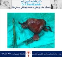 بیمار خانم 52 ساله 1 بیمار خانم 52 ساله 1